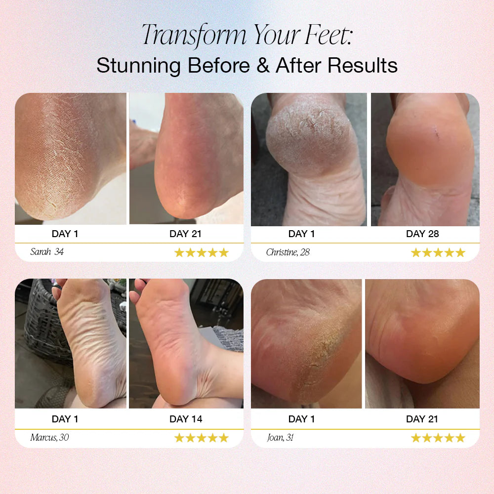 DermaSole Pro